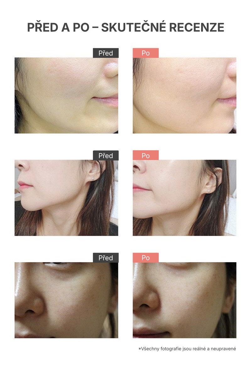 1.5. Detailed Page COOPY PDRN Yeon-Uh Ampoule